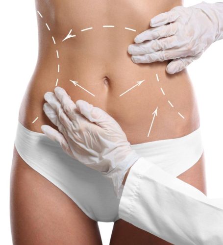 Plastische Chirurgie Wien Körperstraffungen, Fettabsaugung Dr. Roland Resch